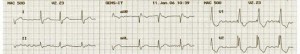 medical writing ecg